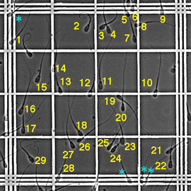 Sperm Quality Inspection Sperm Counting Chamber with Ruby Grid